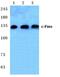 Colony Stimulating Factor 1 Receptor antibody, GTX20298, GeneTex, Western Blot image 