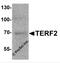 Telomeric Repeat Binding Factor 2 antibody, 7727, ProSci, Western Blot image 