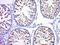 RAD51 Recombinase antibody, orb317801, Biorbyt, Immunohistochemistry paraffin image 