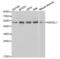 Killer Cell Immunoglobulin Like Receptor, Three Ig Domains And Long Cytoplasmic Tail 1 antibody, abx001361, Abbexa, Western Blot image 