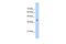 Aldolase, Fructose-Bisphosphate A antibody, GTX46257, GeneTex, Western Blot image 