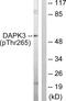 Death Associated Protein Kinase 3 antibody, PA5-38467, Invitrogen Antibodies, Western Blot image 