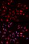 Cholinergic Receptor Muscarinic 5 antibody, LS-C335564, Lifespan Biosciences, Immunofluorescence image 