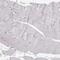 S100 Calcium Binding Protein B antibody, NBP1-87102, Novus Biologicals, Immunohistochemistry paraffin image 