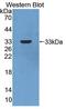 Carbonic Anhydrase 13 antibody, LS-C663302, Lifespan Biosciences, Western Blot image 
