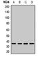 Proteasome 26S Subunit, Non-ATPase 14 antibody, LS-C668269, Lifespan Biosciences, Western Blot image 