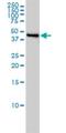 Chromosome 17 Open Reading Frame 75 antibody, H00064149-M01, Novus Biologicals, Western Blot image 