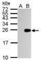 Influenza A Virus M1 antibody, NBP2-14995, Novus Biologicals, Western Blot image 