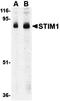 Stromal Interaction Molecule 1 antibody, orb74829, Biorbyt, Western Blot image 