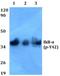 NFKB Inhibitor Alpha antibody, A01139Y42, Boster Biological Technology, Western Blot image 