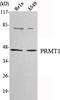 Protein Arginine Methyltransferase 1 antibody, A01417, Boster Biological Technology, Western Blot image 