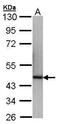 IL-12 antibody, PA5-28477, Invitrogen Antibodies, Western Blot image 