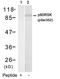 Ribosomal Protein S6 Kinase A1 antibody, GTX50177, GeneTex, Western Blot image 