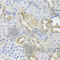 Cathepsin C antibody, A8403, ABclonal Technology, Immunohistochemistry paraffin image 