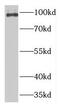 Transportin 2 antibody, FNab08844, FineTest, Western Blot image 