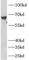 Atlastin GTPase 2 antibody, FNab00683, FineTest, Western Blot image 