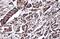 DEAD-Box Helicase 3 X-Linked antibody, GTX110614, GeneTex, Immunohistochemistry paraffin image 