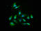 AKT Serine/Threonine Kinase 2 antibody, LS-C370815, Lifespan Biosciences, Immunofluorescence image 