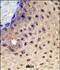 Paired Box 3 antibody, A00285, Boster Biological Technology, Immunohistochemistry paraffin image 