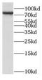 Non-SMC Condensin I Complex Subunit H antibody, FNab05579, FineTest, Western Blot image 