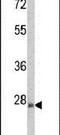 Rho Family GTPase 3 antibody, PA5-14842, Invitrogen Antibodies, Western Blot image 