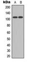 Ataxin 1 antibody, LS-B14568, Lifespan Biosciences, Western Blot image 