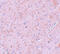 E3 SUMO-protein ligase PIAS2 antibody, 5743, ProSci Inc, Immunohistochemistry paraffin image 