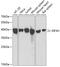 Eukaryotic Translation Initiation Factor 3 Subunit H antibody, GTX65839, GeneTex, Western Blot image 