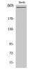 Coagulation Factor VIII antibody, GTX34370, GeneTex, Western Blot image 