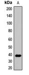 Protein Wnt-3a antibody, LS-C668905, Lifespan Biosciences, Western Blot image 