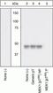 Mitogen-Activated Protein Kinase Kinase 1 antibody, GTX25612, GeneTex, Western Blot image 
