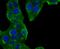 Golgi Membrane Protein 1 antibody, NBP2-66876, Novus Biologicals, Immunocytochemistry image 