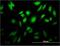 Testis Associated Actin Remodelling Kinase 2 antibody, H00010420-M02, Novus Biologicals, Immunocytochemistry image 