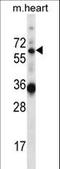 GATA Zinc Finger Domain Containing 2B antibody, LS-C166386, Lifespan Biosciences, Western Blot image 