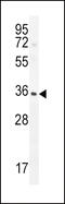 Insulin-like growth factor-binding protein 3 antibody, 63-091, ProSci, Western Blot image 