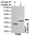 Coactivator Associated Arginine Methyltransferase 1 antibody, GTX49171, GeneTex, Immunoprecipitation image 