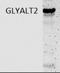 Glycine-N-Acyltransferase Like 2 antibody, NBP2-32526, Novus Biologicals, Western Blot image 