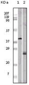 Apolipoprotein M antibody, abx015722, Abbexa, Enzyme Linked Immunosorbent Assay image 