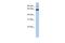 Protein Phosphatase 1 Regulatory Subunit 21 antibody, A15058, Boster Biological Technology, Western Blot image 