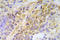 Checkpoint Kinase 2 antibody, LS-C178127, Lifespan Biosciences, Immunohistochemistry paraffin image 