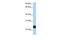 Transmembrane Protein 123 antibody, GTX45892, GeneTex, Western Blot image 