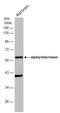 Internexin Neuronal Intermediate Filament Protein Alpha antibody, GTX130053, GeneTex, Western Blot image 