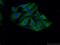 Asparagine Synthetase (Glutamine-Hydrolyzing) antibody, 14681-1-AP, Proteintech Group, Immunofluorescence image 