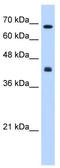 Carbohydrate Sulfotransferase 8 antibody, TA338606, Origene, Western Blot image 