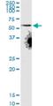 Solute Carrier Family 22 Member 8 antibody, H00009376-M02, Novus Biologicals, Western Blot image 