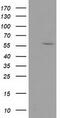 Dystrobrevin Alpha antibody, CF502207, Origene, Western Blot image 