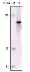 FES Proto-Oncogene, Tyrosine Kinase antibody, MA5-15351, Invitrogen Antibodies, Western Blot image 