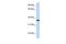 Lipocalin 12 antibody, GTX44850, GeneTex, Western Blot image 