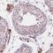 Alport Syndrome, Mental Retardation, Midface Hypoplasia And Elliptocytosis Chromosomal Region Gene 1 antibody, HPA000590, Atlas Antibodies, Immunohistochemistry frozen image 