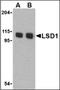 Lysine Demethylase 1A antibody, orb89160, Biorbyt, Western Blot image 